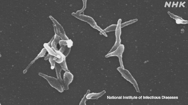 Die Fälle von Mykoplasmen-Pneumonie erreichen in Japan einen Rekordwert